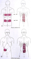 A4.11.Cơ thẳng to bụng-Rectus_Abdominis