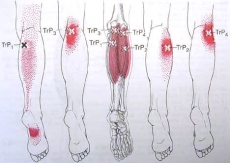 A6.20.Cơ bụng chân-Gastrocnemius.