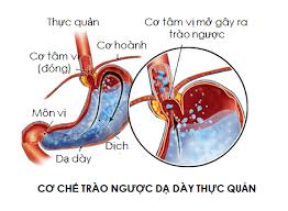 TRÀO NGƯỢC THỰC QUẢN