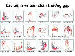 Đau Bàn Chân