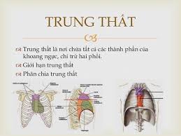 Đau thần kinh Trung thất