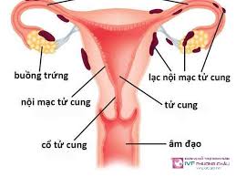 LẠC NỘI MẠC TỬ CUNG